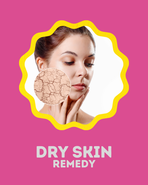 Dry Skin Remedy